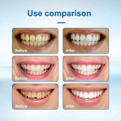 Dental Cleaning Solution for Plaque and Bad Breath Care