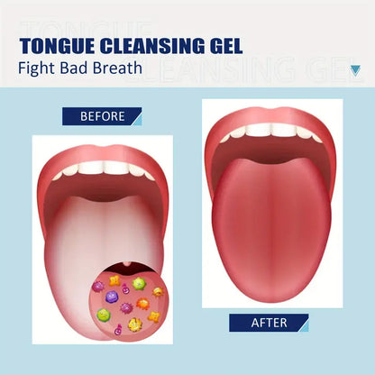 Instant Bad Breath & Halitosis Brush and Gel Kit