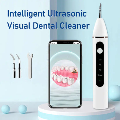 Ultrasonic Tooth Stain Remover for Home Use
