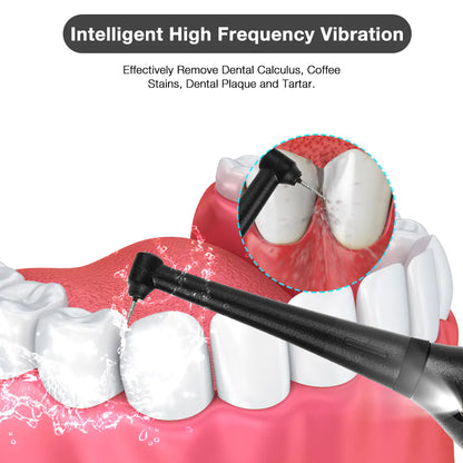 Electric Dental Cleaner Tooth Whitening Device