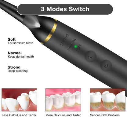 Electric Dental Cleaner Tooth Whitening Device