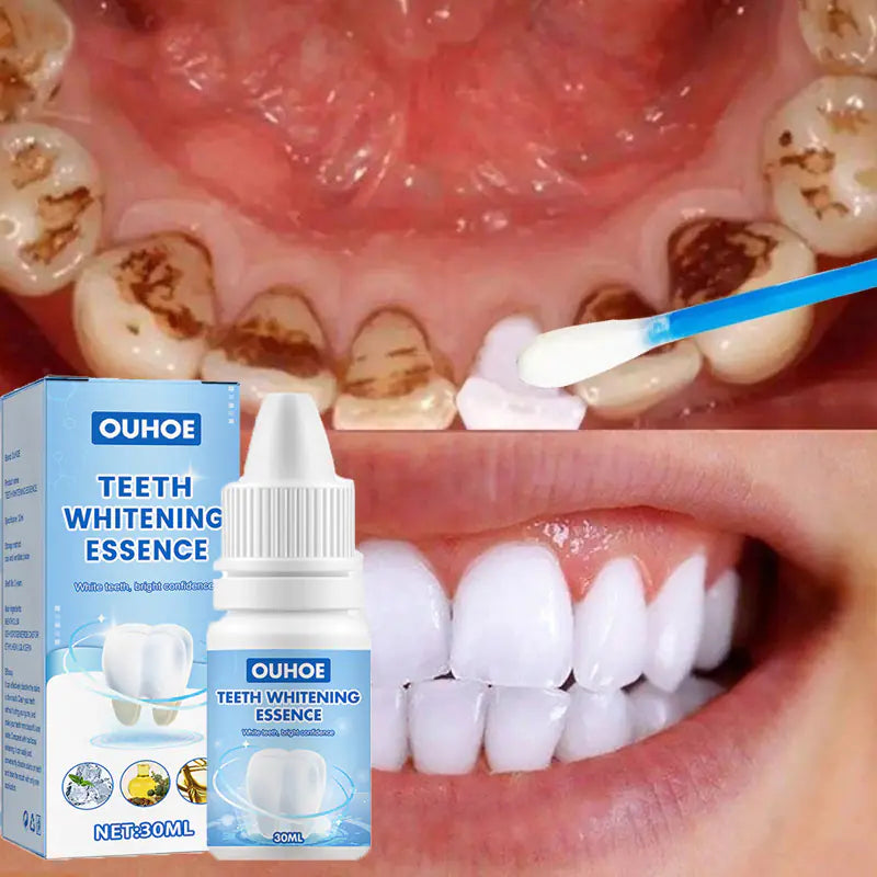 Dental Cleaning Solution for Plaque and Bad Breath Care