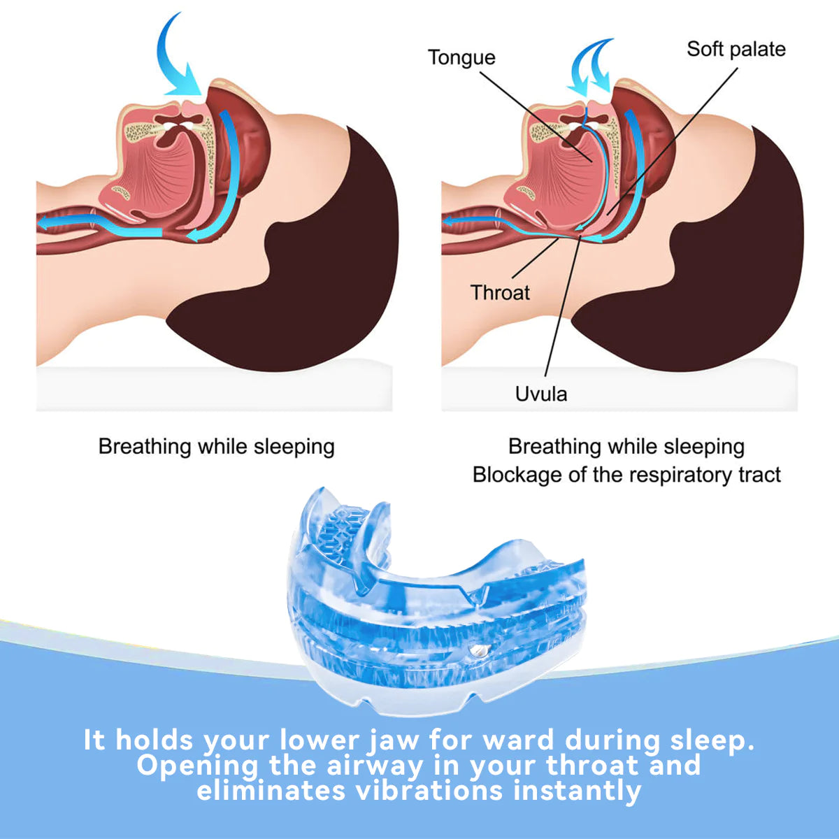 Adjustable Nighttime Dental Guard – Anti-Grinding Protection