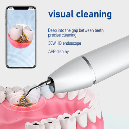 Ultrasonic Tooth Stain Remover for Home Use