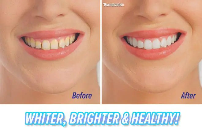 Teeth Cleaner and Polishing Vibrating Tooth Device