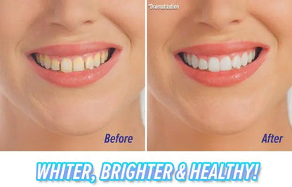 Teeth Cleaner and Polishing Vibrating Tooth Device